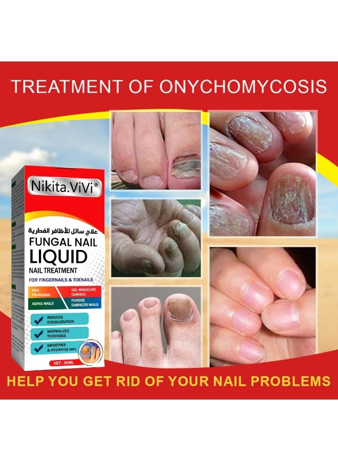 NIKITA.VIVI Fungal Nail Treatment Liquid 30ml Nail Fungus Treatment for Toenails & Fingernails Fungal Nail Renewal Anti Fungus Nail Repair Smooth & Hydrates Nail Reduce Discoloration - Image 5