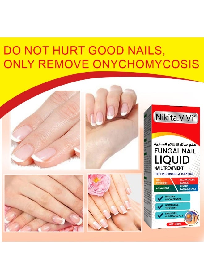 NIKITA.VIVI Fungal Nail Treatment Liquid 30ml Nail Fungus Treatment for Toenails & Fingernails Fungal Nail Renewal Anti Fungus Nail Repair Smooth & Hydrates Nail Reduce Discoloration - Image 4