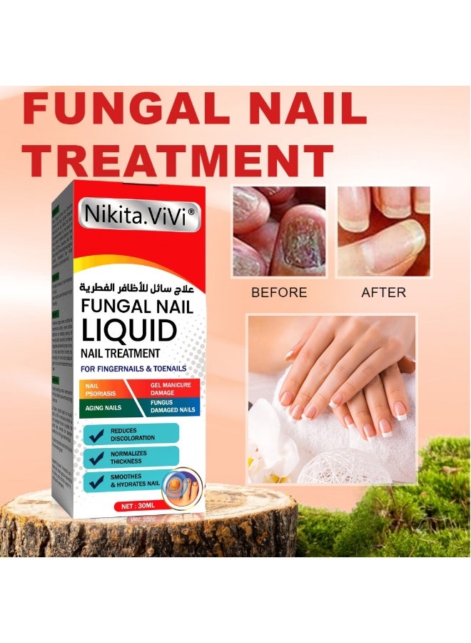NIKITA.VIVI Fungal Nail Treatment Liquid 30ml Nail Fungus Treatment for Toenails & Fingernails Fungal Nail Renewal Anti Fungus Nail Repair Smooth & Hydrates Nail Reduce Discoloration - Image 3
