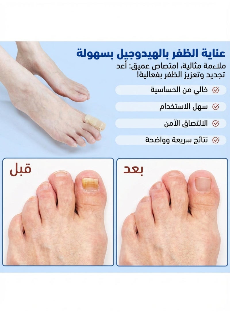 2-Pack Ingrown Toenail Correction Patches, Antibacterial Nail Repair Stickers for Thick or Fungal Nails, Foot Care Nail Protection ✨ - Image 5