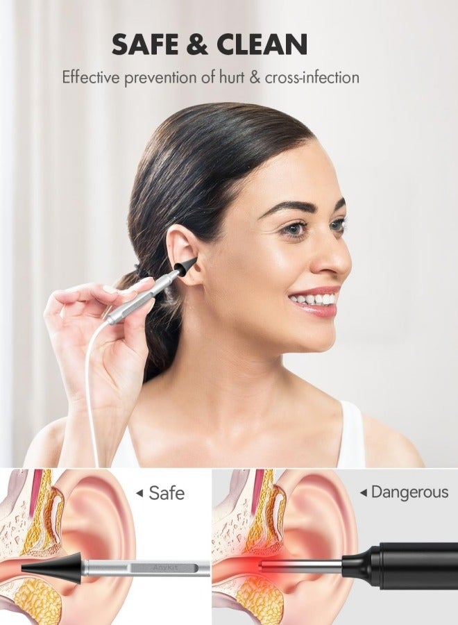 Ru syanl Digital Otoscope with Gyroscope 4.5 Inches Screen 3.9mm Ear Scope Camera with 6 Lights Earwax Removal Tool 32GB TF Card Supports Photo Snap and Video Recording  - Image 2