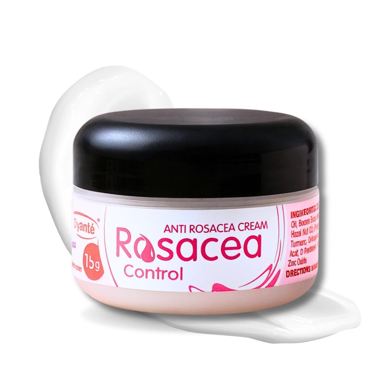 Ovante Rosacea Facial Redness Control Cream For Rosacea, Red Acne Bumps, Hydrate Soothe and Calm Dry Itchy Rosacea Prone Skin - 0.5 oz - Image 1