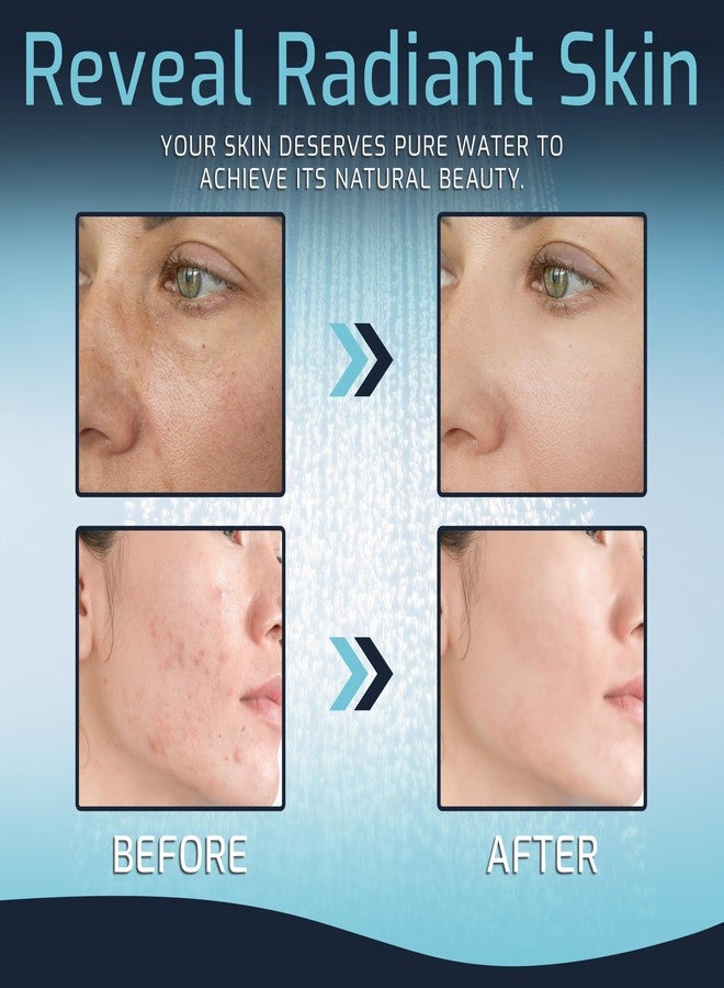 Mist Filtered Shower Head, Revitalizing 15 stage Shower Filter Combo, Improves The Condition of Your Skin & Hair, Shower Water Softener with High Output, Chrome - Shower filter for Hard Water - Image 2