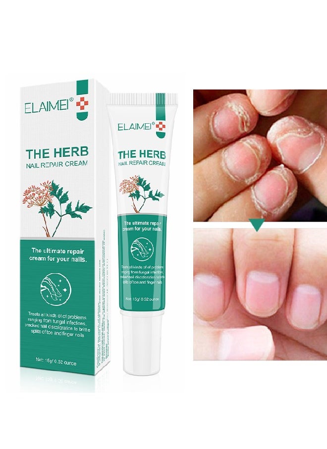 Elaimei Herb Nail Repair Cream, Nail Repair Essence Cream, Restores Appearance Of Discolored Or Damaged Nails, Toe Be Health Instant Beauty Cream For Toenail Care Under The Nail 15G  - Image 1