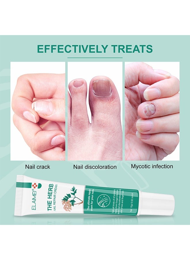 Elaimei Herb Nail Repair Cream, Nail Repair Essence Cream, Restores Appearance Of Discolored Or Damaged Nails, Toe Be Health Instant Beauty Cream For Toenail Care Under The Nail 15G  - Image 4