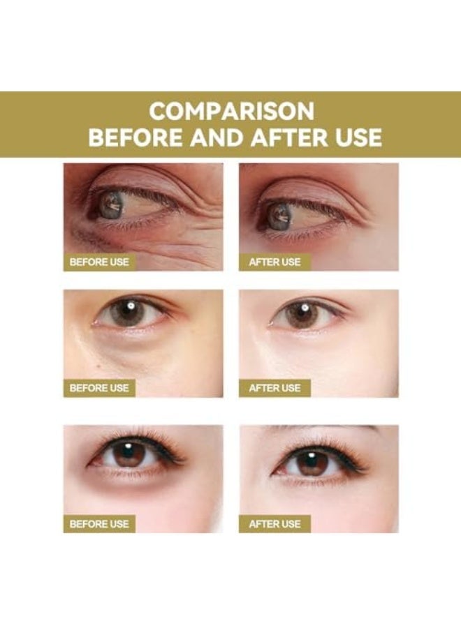 EELHOE MICRODARTS EYE PATCH Microneedle Eye Patches for Dark Circles and Puffy Eyes, Anti-Wrinkle Under Eye Treatment with Deep Hydration and Brightening, Day and Night Use for All Skin Types - Image 4