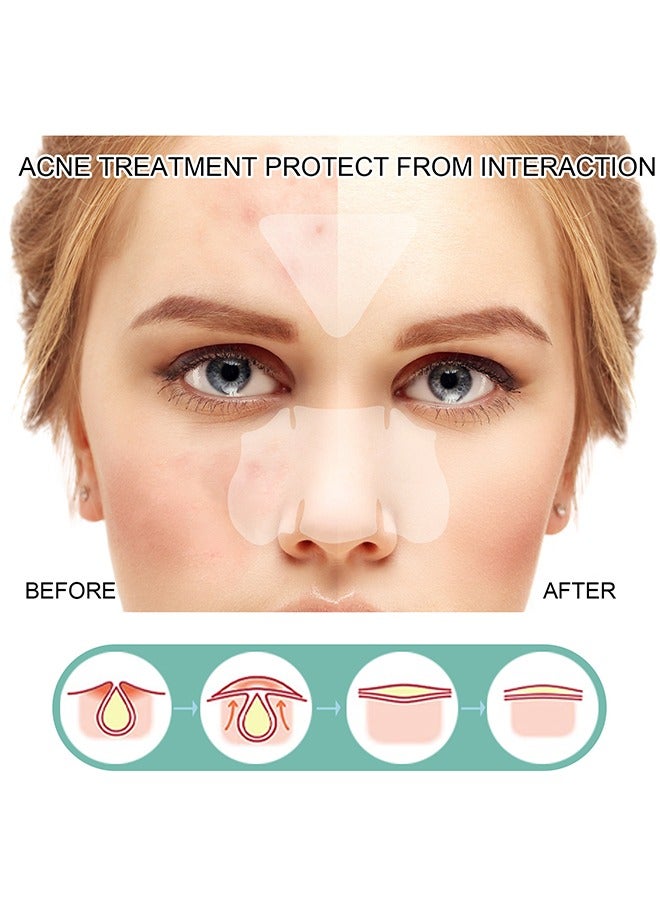 EELHOE Pimple Patches Acne Patches, 5 Sizes 132 Patches Pimple Patches For Face, Chin Or Body, Acne Treatment with Tea Tree And Salicylic Acid, Hydrocolloid Bandages For Acne Skin - Image 5