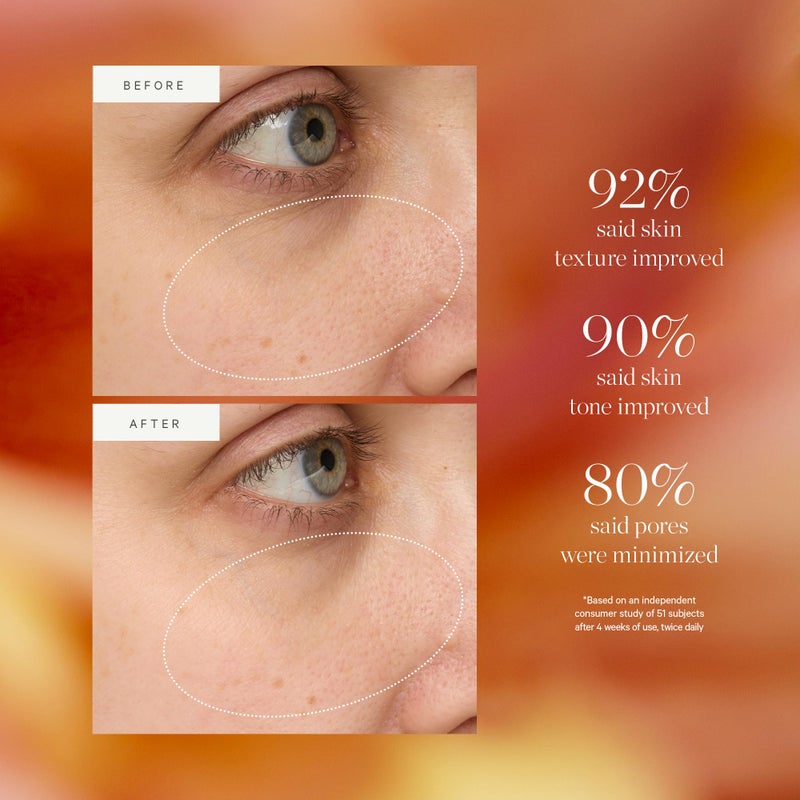 Kora Organics قطرات كورا أورغانيكس الكركم المتلألئة، سيروم وجه معتمد عضوي مع بديل النياسيناميد، يحسن الملمس ومظهر المسام، نباتي، 0.34 أونصة سائلة - Image 4