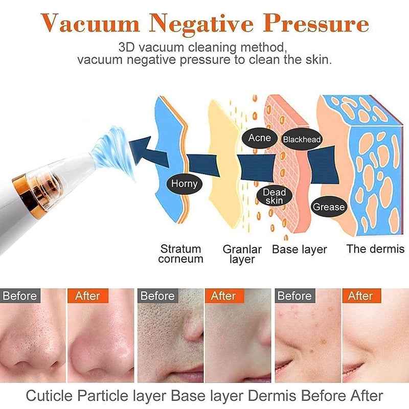 Jashal 6in1 MultiFunction Blackhead and Whitehead Extractor Remover Device USB Rechargeable Pore Cleaner Vacuum Suction Tool for Men and Women - Image 5
