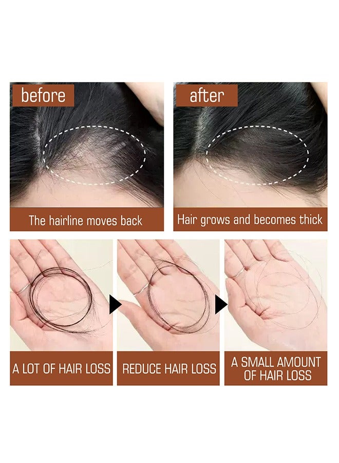 EELHOE 100% Batana Oil - Hair Growth Healthier Thicker Fuller Hair, Batana oil, Batana Oil for Hair Growth, Batana Oil Organic, Batana Oil Organic for Healthy Hair, Batana Oil Hair Mask 120ml - Image 4