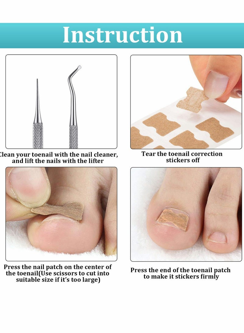 KASTWAVE Ingrown Toenail Tool Set, Including Ingrown Toenail File and Lifter, 60 Pieces Elastic Patch Curved Toenails Brace Stickers, 60 Pieces Ingrown Toenail Correction Stickers (122 Pieces) - Image 5