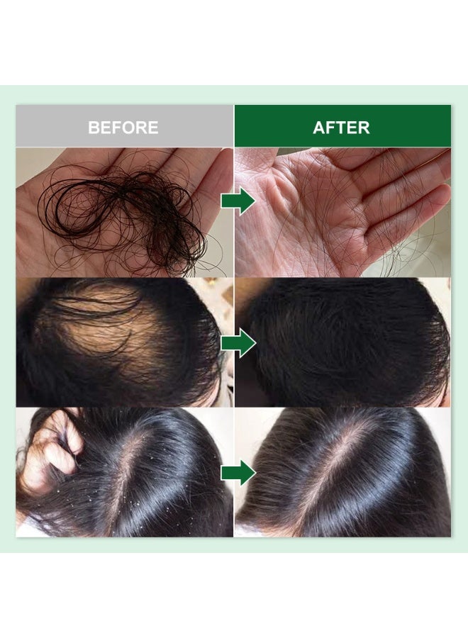 PURC Rosemary Hair Care Oil Peppermint Ginger Hair Care Scalp Care Oil 50ML - Image 3