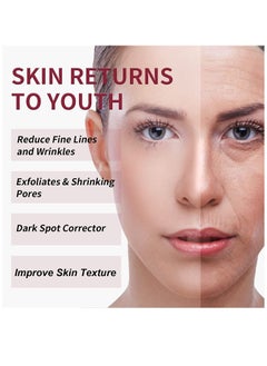MOOYAM AHA 30% + BHA 2% Peeling Solution Exfoliating AHA 30% BHA 2% Peeling Solution Anti Acne Serum Chemical Peel for Face at Home BHA AHA Mask Red Peel BHA Liquid Exfoliant for Blemishes Wrinkle 30ml  - Image 2