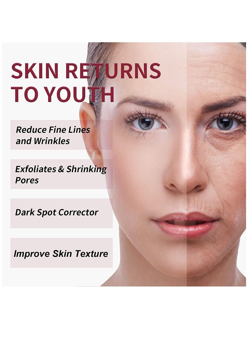 MOOYAM AHA 30% + BHA 2% Peeling Solution Exfoliating AHA 30% BHA 2% Peeling Solution Anti Acne Serum Chemical Peel for Face at Home BHA AHA Mask Red Peel BHA Liquid Exfoliant for Blemishes Wrinkle 30ml  - Image 2