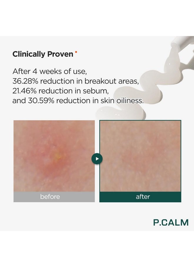 P.CALM Centella Trouble Spot 0.5 Fl.Oz Vegan Breakout Relief Cream For Sensitive Skin Korean Skin Care  - Image 3