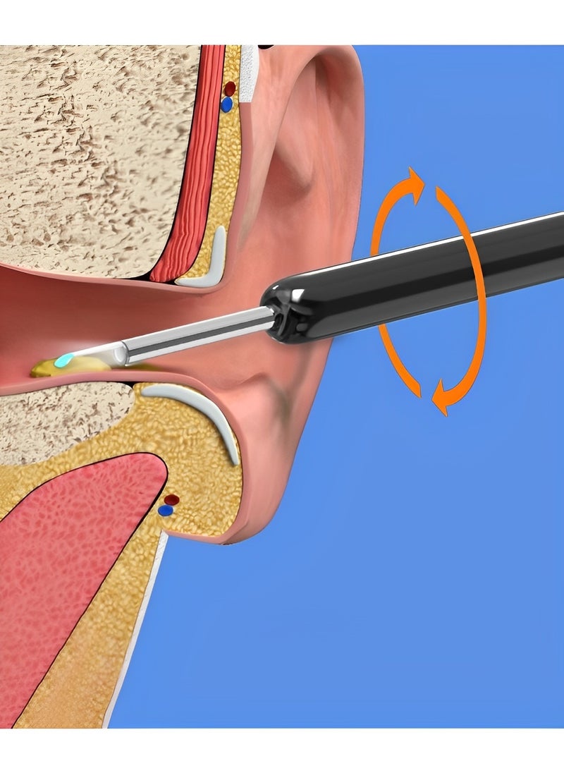 أداة إزالة شمع الأذن، منظف الأذن مع كاميرا للأذن عالية الدقة 1080 بكسل، منظار الأذن اللاسلكي مع أدوات إزالة شمع الأذن المرئية بالضوء - pzsku/Z51ADC4E58FCBC4C5ABD4Z/45/_/1709805241/4ddcbb79-6986-4b7e-858e-c716e253c987