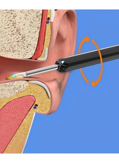 REOCLE Ear Wax Removal Tool Camera Ear Cleaner with Ear Camera HD 1080P Wireless Ear Scope Otoscope with Light Visual Earwax Removal Kits  - Image 4
