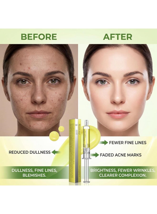 ATRJSZ Retinol Shot Tightening Booster - 0.1% Retinol, 1% Panthenol & 9 Peptides Anti-Aging Face Serum - Visibly Reduces Wrinkles, Fine Lines & Restores Elasticity - Airless Syringe Applicator - 10ml - Image 4
