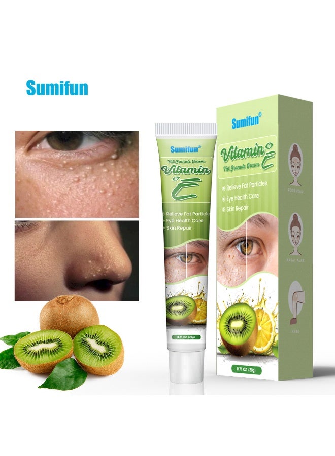 سوميفون كريم حبيبات الدهون بفيتامين E، 20 جرام، إزالة فعالة لجزيئات الدهون، دعم صحة العين - Image 1