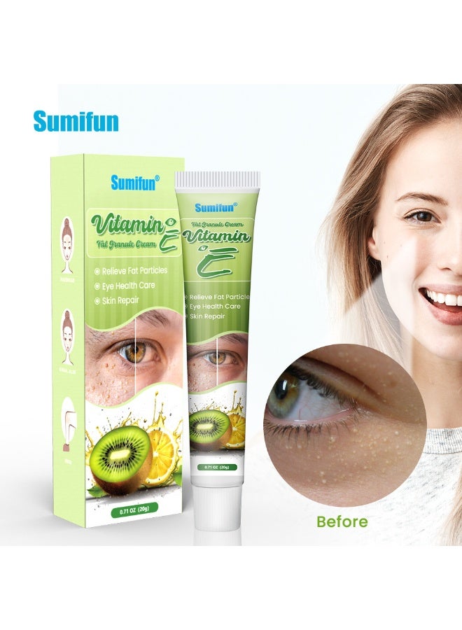 سوميفون كريم حبيبات الدهون بفيتامين E، 20 جرام، إزالة فعالة لجزيئات الدهون، دعم صحة العين - Image 2