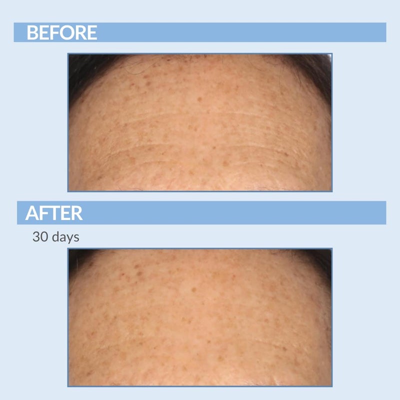 Serious Skincare Vitamin A Force XR Retinol Serum Concentrate - Micro Exfoliate & Resurface for Radiant Skin - For Lines, Wrinkles - Pore Minimizer - Encapsulated Retinol for Anti-Aging - Serious Skincare - 1 Oz. - Image 5