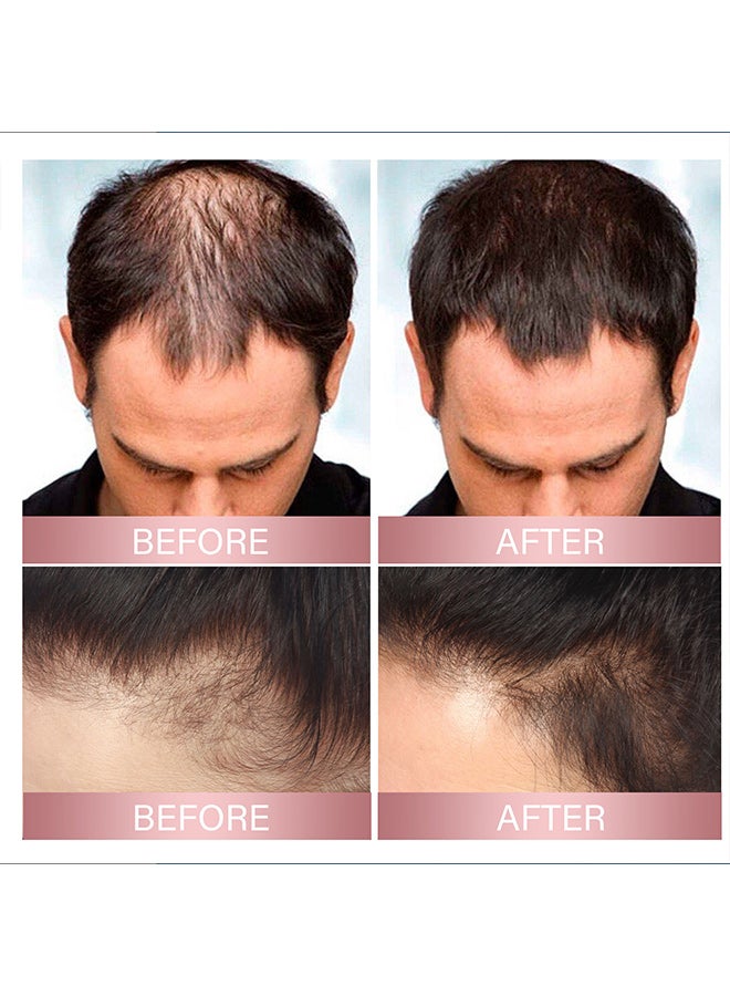 إيلهو بخاخ العناية بالشعر بالأرز من إيلهو، يقوي الشعر، ويرطب فروة الرأس، وينعم، ويغذي، ويلمع، ويرطب الشعر. - Image 4