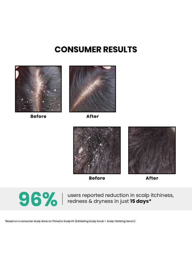 ثريفيكو مقشر فروة الرأس من ثرايفكو AHA BHA PHA | يعزز نمو الشعر، ويزيل القشرة والجلد الميت والزيوت وتراكم المنتجات | يُعالج فروة الرأس الجافة والمتقشرة والحكة | للرجال والنساء | مناسب للسفر | 25 مل - Image 5