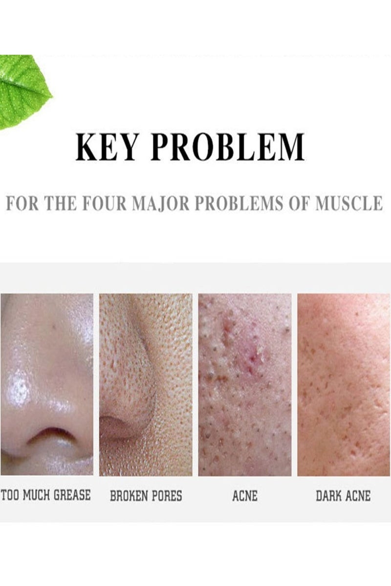 Aichun beauty Kind to Skin Soothing Acne Cream Face Acne Cleaning Cream Skin Care Remove Repair Comedone Pimple Acne Face Acne Cream Oil Control and Skin Calming Formula for Clear Smooth Skin Anti Pimple Treatment Cream 30ml - Image 3