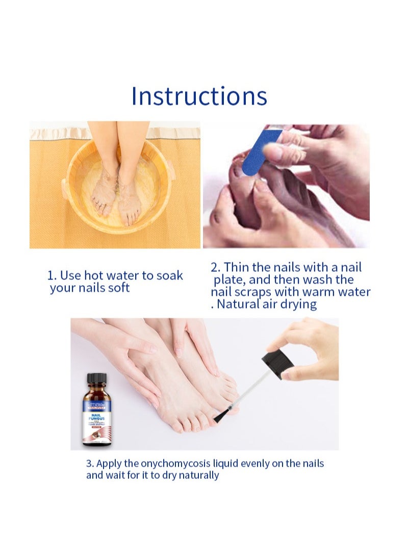 HEALMUSZ - Toenail Fungus Treatment Extra Strength-Fungal Nail Treatment for Toe Nail and Fingernails-Tea Tree Oil Nail Repair Solution for Thick/Broken/Discolored Nails-Renews Damaged Cracked Ingrown Toenail - Image 1