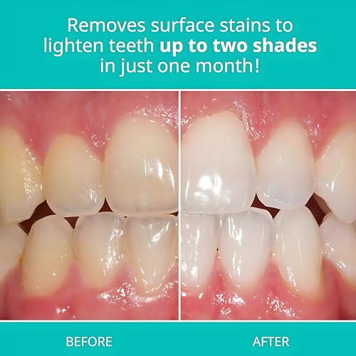 Opalescence Whitening Toothpaste Travel Size 1 Ounce 6 Pack Fluoride Teeth Whitening Toothpaste Travel Size Original Mint Flavor 4026 - Image 3