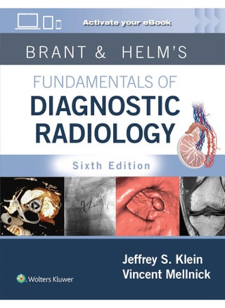 Brant & Helm's Fundamentals of Diagnostic Radiology: Print + eBook with Multimedia - pzsku/Z51D77AFFA130CC5EFE84Z/45/_/1737571043/3e2a6a75-d901-4371-8d1d-2f2a3f2f6f39