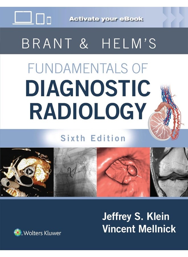 Brant & Helm's Fundamentals of Diagnostic Radiology: Print + eBook with Multimedia
