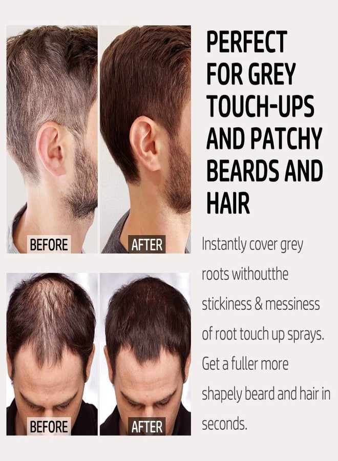 يونغفوكس غطاء جذور الشعر من يونغ فوكس - Image 3