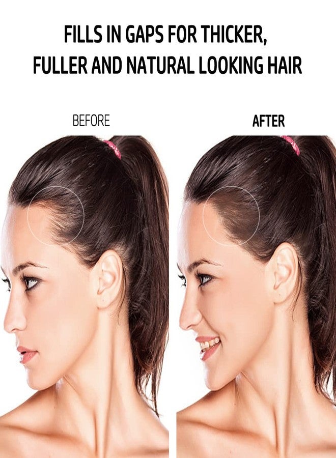 يونغفوكس غطاء جذور الشعر من يونغ فوكس - Image 2