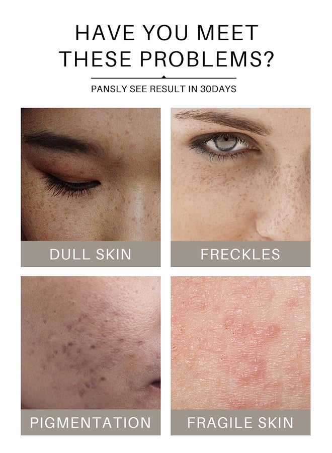 روبيريل قناع الطين بالكركم، فيتامين سي والألوة فيرا لتنظيف المسام السوداء بترطيب، عناية لتفتيح البشرة، قناع الطين بالكركم للتحكم في حب الشباب، الزيت وتنقية المسام، تقليل المسام السوداء، البقع الداكنة. - Image 3