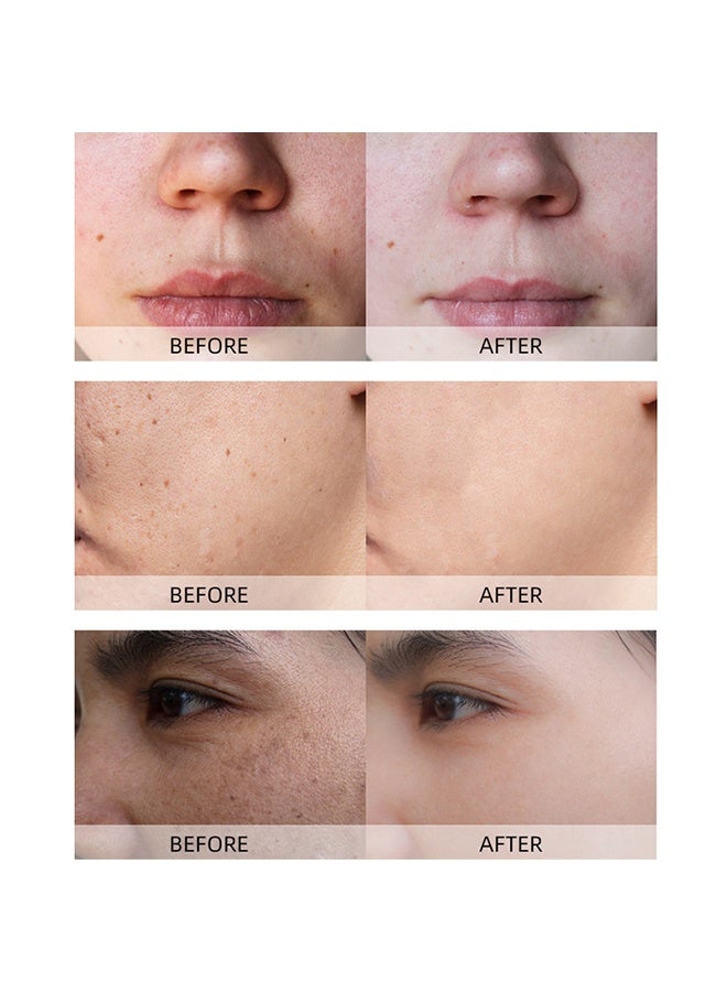 روبيريل قناع الطين بالكركم، فيتامين سي والألوة فيرا لتنظيف المسام السوداء بترطيب، عناية لتفتيح البشرة، قناع الطين بالكركم للتحكم في حب الشباب، الزيت وتنقية المسام، تقليل المسام السوداء، البقع الداكنة. - Image 5