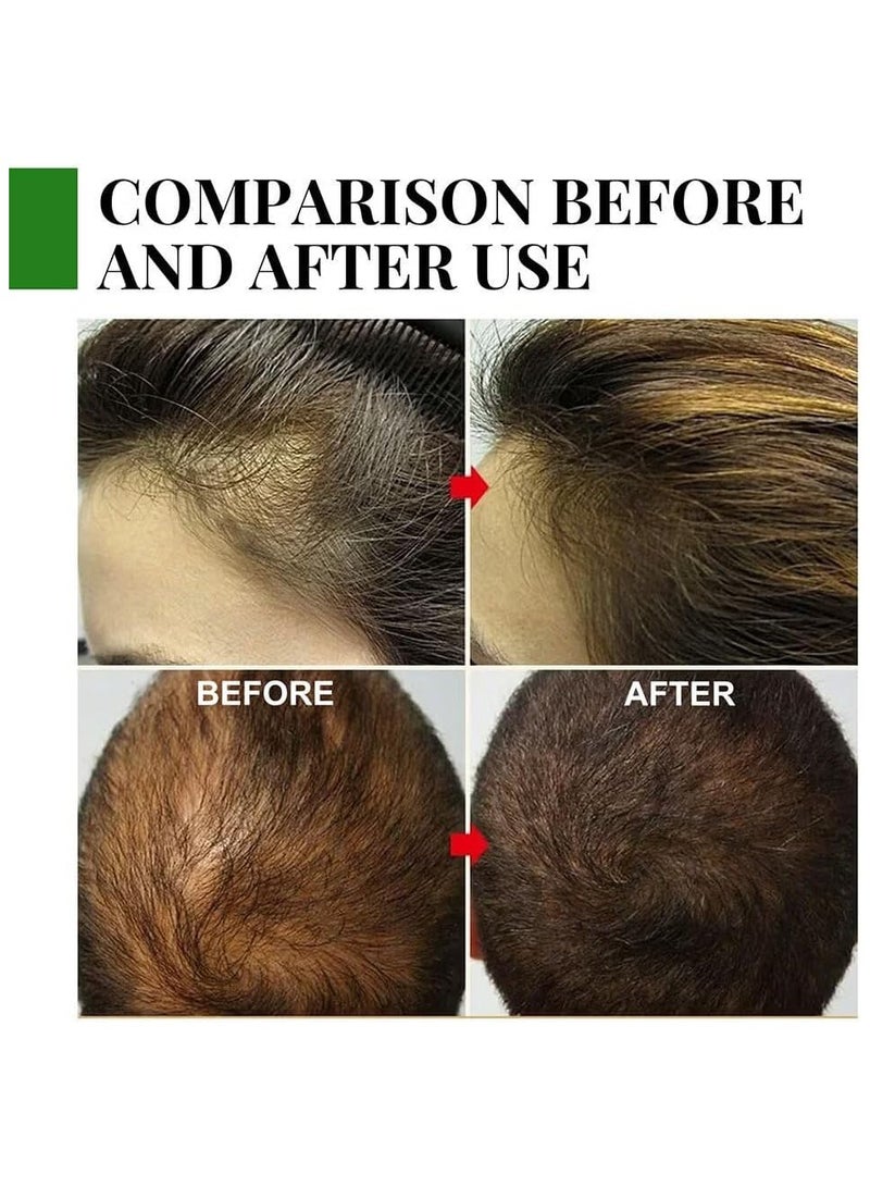 إيلهو زيت إكليل الجبل لنمو الشعر 30 مل - Image 4