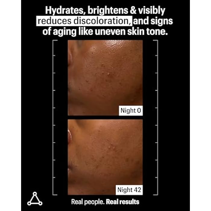 Allies of Skin Mandelic Pigmentation Corrector Night Serum | Gentle Acne Face Serum with Bakuchiol, Niacinamide & Salicylic Acid | Anti-Aging Formula to Reduce Pores and Even Skin Tone (1 oz) - Image 4