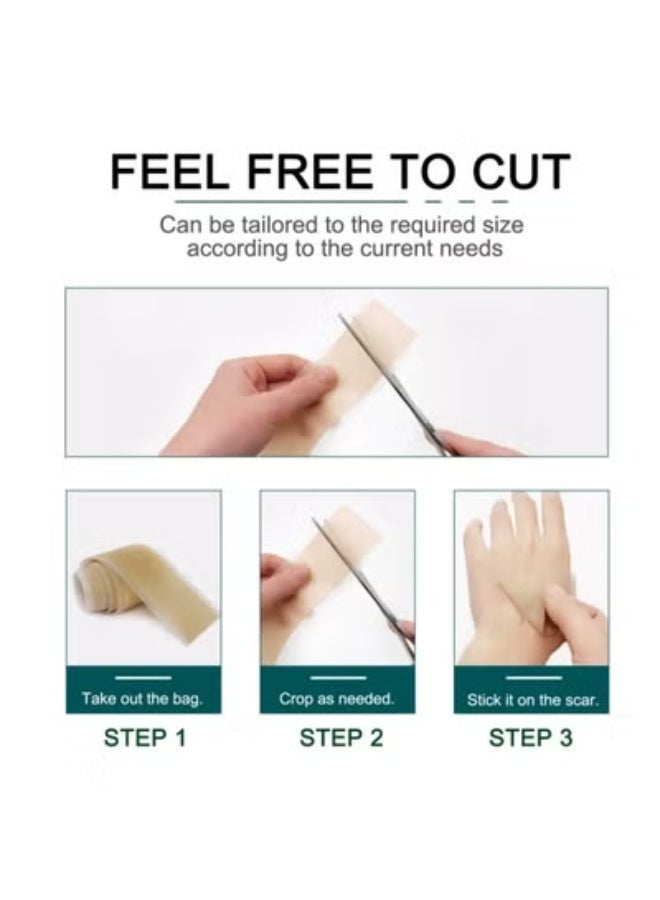 CARVENCHY Silicone Scar Tape Roll Scar Silicone Strips Reusable Professional Scar Removal Sheets for Section Surgery Burn - Image 3