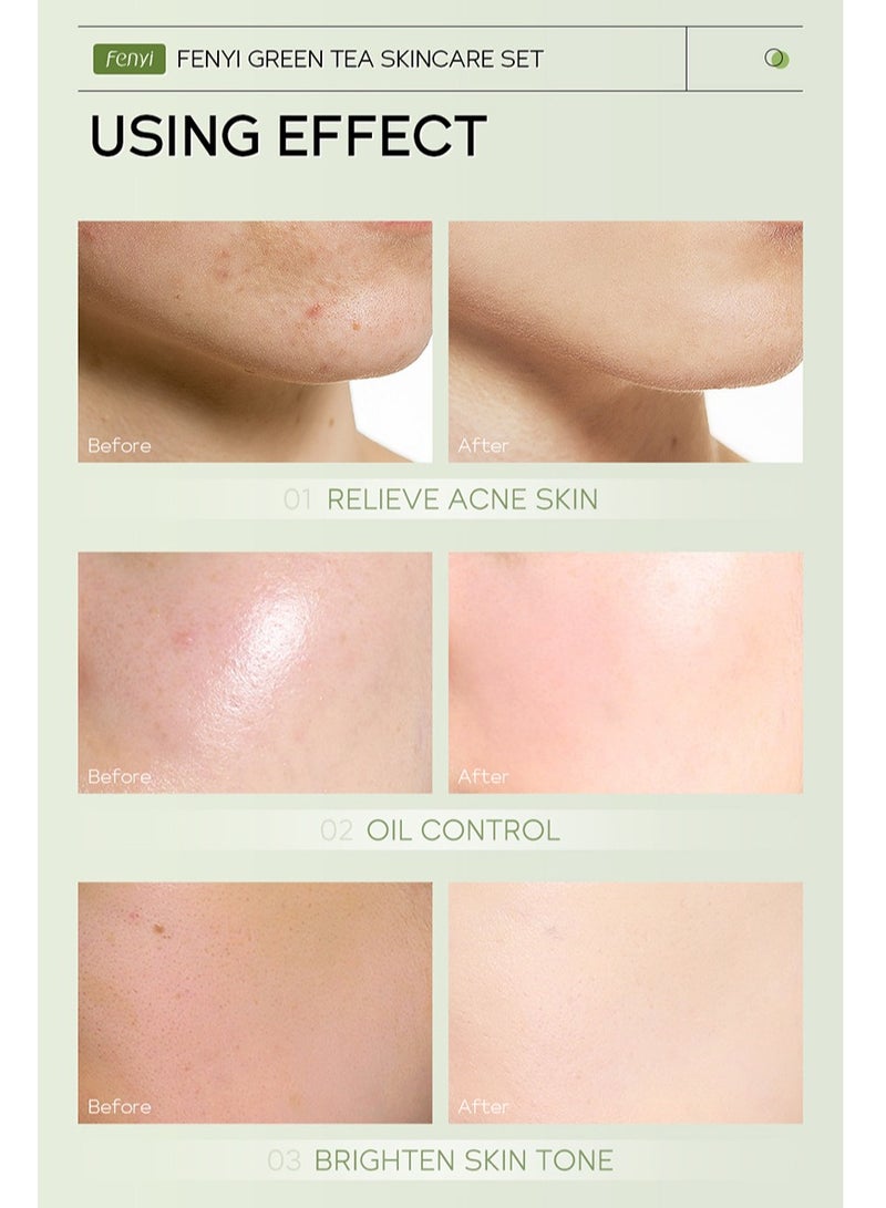 فيني مجموعة منتجات العناية بالوجه والعناية بالبشرة بالشاي الأخضر 6 قطع/ترطيب/تفتيح لون البشرة/مناسبة لأي نوع بشرة - Image 4