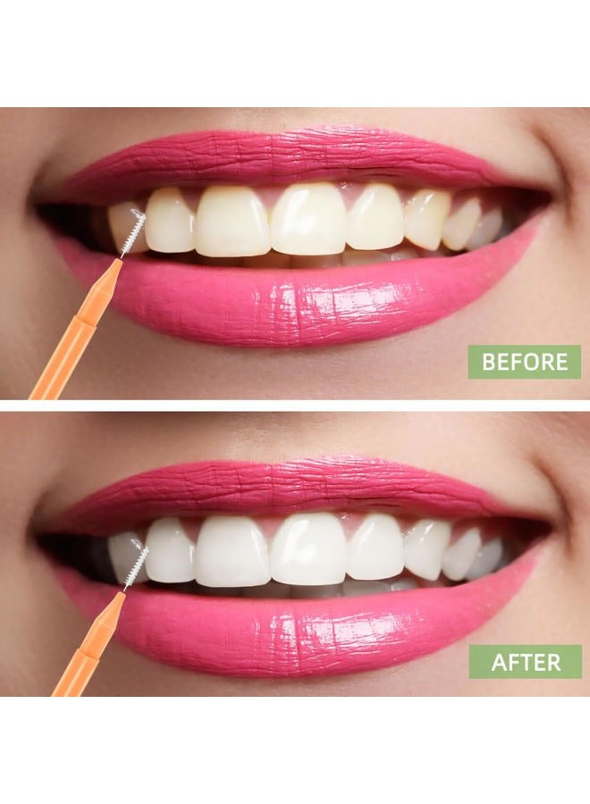 yuntop 75 Pieces Braces Brush for Tooth Dental Tooth Flossing Braces Brush Toothpick for Interdental Cleaning Oral Tooth Cleaning Tool for Dental Hygiene Bendable Flosser Head Tooth Cleaner 5 Colors Floss - Image 5