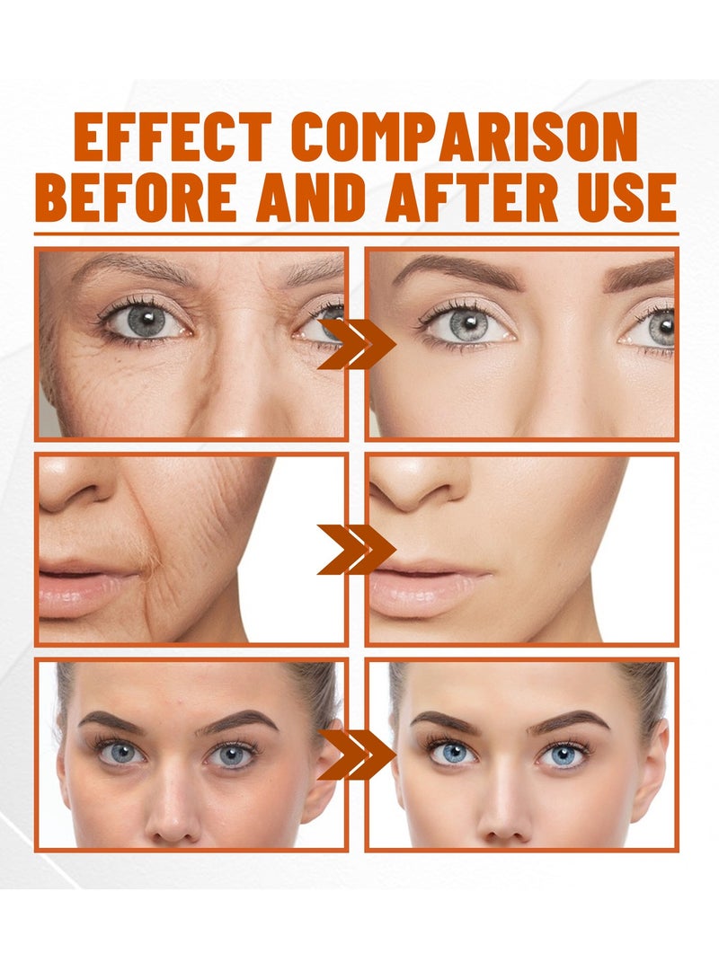 إيلهو فيتامين سي سيروم للوجه 50 مل + قناع كولاجين مركز 5 قطع ، رذاذ مرطب للوجه بحمض الهيالورونيك لتفتيح مصل تفتيح أقدام الغراب للتجاعيد وخطوط الرقبة - Image 2