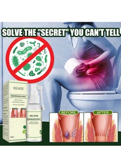 EELHOE 30ML Hemorrhoid Spray, Korean Natural Herbal Hemorrhoids Spray Pain Itch Relief, Hemorrhoid and Fissure Treatment, Hemmoroids Treatment Removal Spray (1pcs)  - Image 5