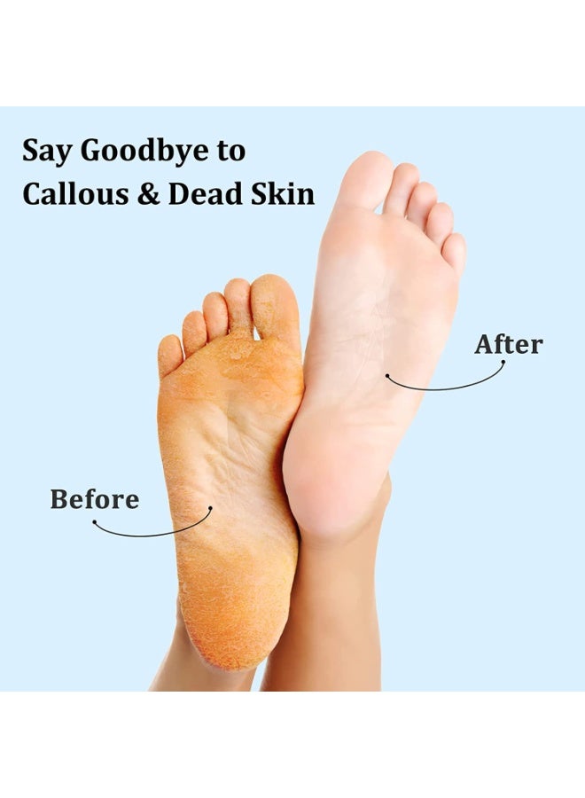 أجهزة إزالة أقدام الفولاذ المقاوم للصدأ مزدوجة الجانب ، أجهزة غسيل أقدام محترفة للجلد الميت والكعب الجاف ، أدوات إزالة أقدام قابلة لإعادة الاستخدام للأقدام الجافة والرطبة - Image 3