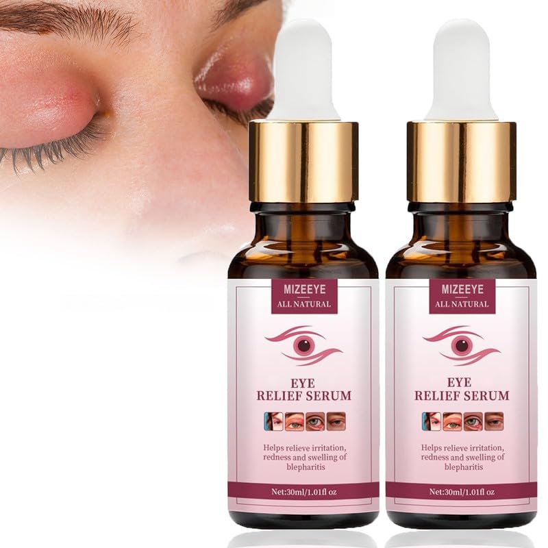 MIZEEYE Chalazion Eye Treatment For Blepharitis 2 PCS Moisturize Eyelids Serum and Chalazion Remover Gentle Under Eye Relief Serum For Dark Circles Eye Bags Puffiness - Image 1