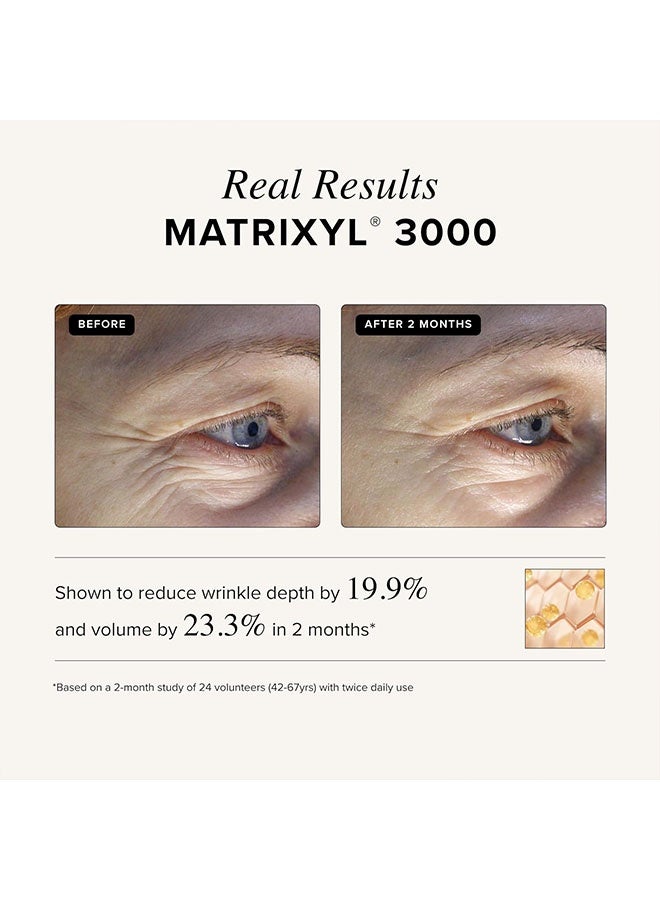 أستروود Matrixyl 3000 + Argireline Serum 29ml, مكافحة الشيخوخة, تعزيز الكولاجين وتقليل التجاعيد, مصل مكافحة الشيخوخة مع حمض الهيالورونيك, مصل الببتيدات للوجه - Image 4