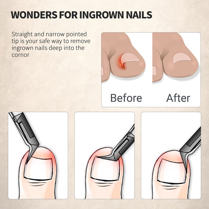 FERYES Toenail Clipper Straight Blade for Ingrown and Thick Nails - Stainless Steel and Sharp Pointed Tip Ingrown Nail Clipper â€“ Wide Jaw Toe Nail Cutter Ingrown Tool - Image 3