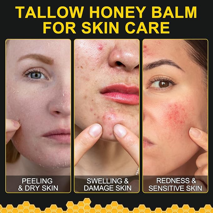 KZUO Beef Tallow for skin, Beef Tallow, Hydrating Tallow Balm with Raw Honey and Beeswax, Grass-Fed Beef Tallow & Raw Wild Honey Blend, Body & Face Moisturizer, Natural Formula - Image 2