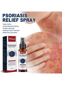 SOUTH MOON Eczema Therapy Spray 30ml, All Natural Eczema Treatment, Psoriasis Treatment, Fast Relieve Itching and Redness，Skin Care Pain Itch Therapy Spray  - Image 4