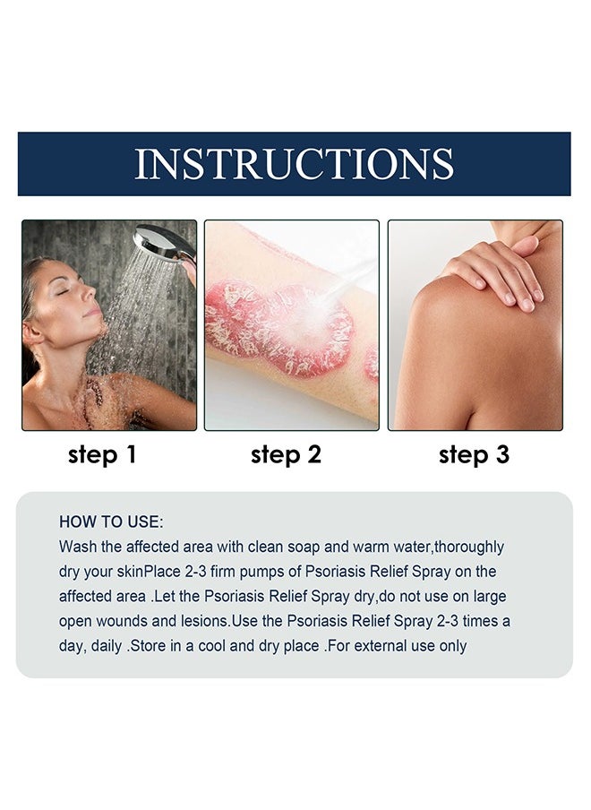 SOUTH MOON - Eczema Therapy Spray 30ml, All Natural Eczema Treatment, Psoriasis Treatment, Fast Relieve Itching and Redness，Skin Care Pain Itch Therapy Spray - Image 1